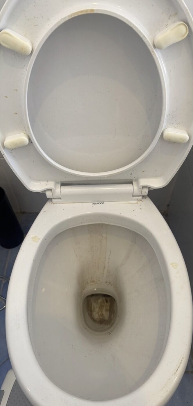 Toilet before — staining at waterline and under rim